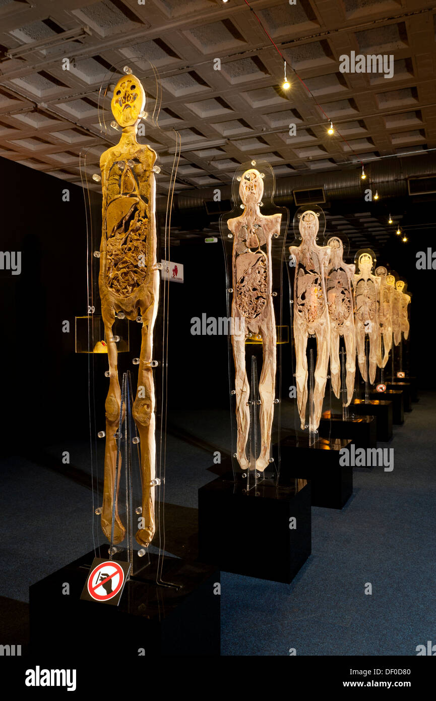 Plastination specimen of human body, parallel sections Stock Photo Alamy