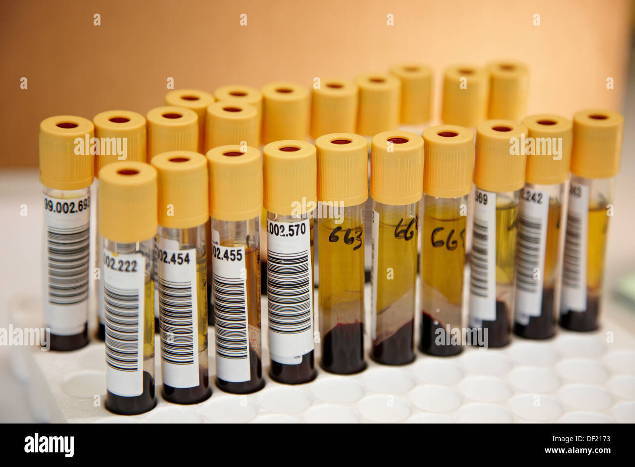Rna extraction hires stock photography and images Alamy