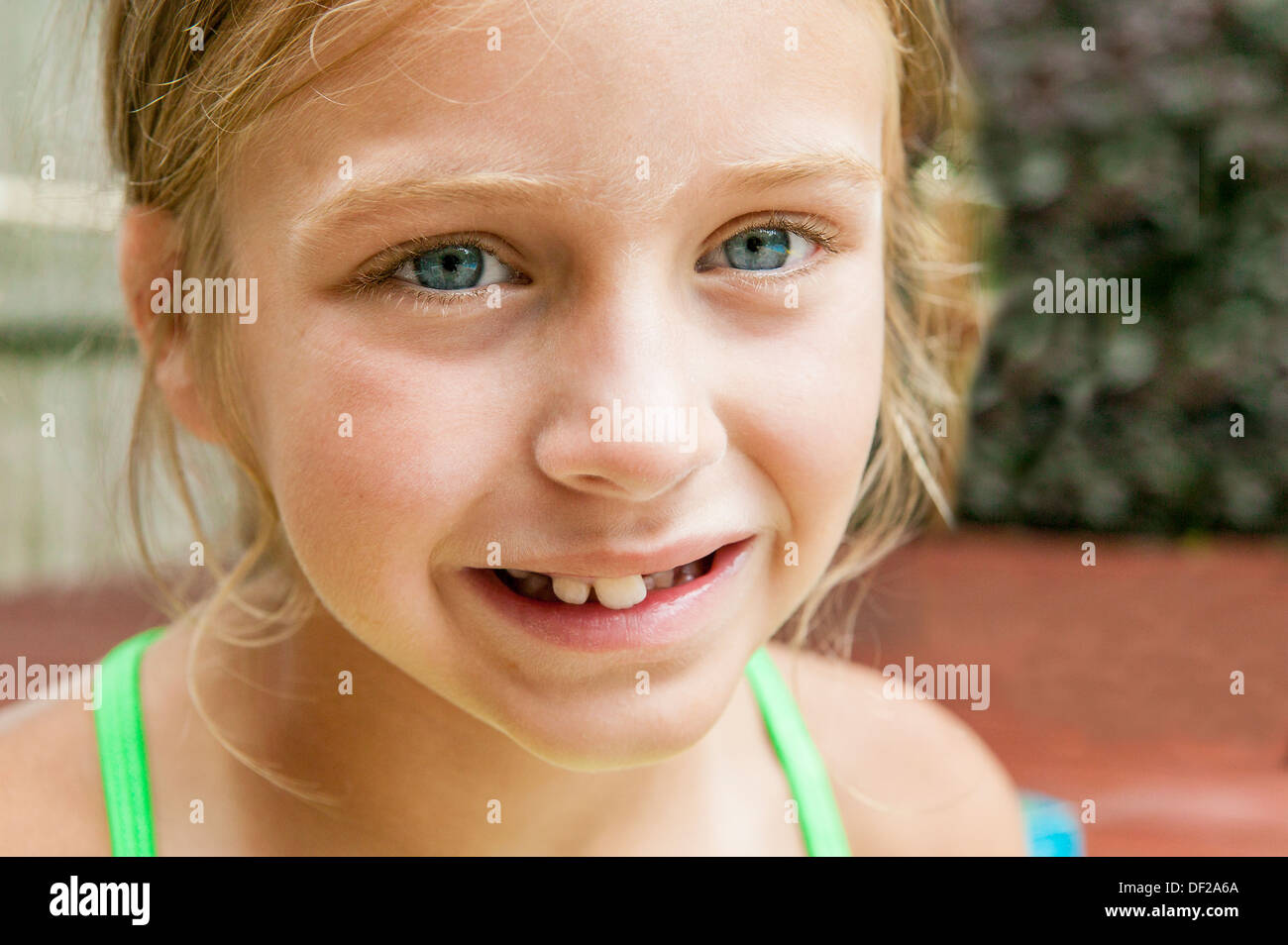 Young Caucasian girl smiling with missing teeth in her upper front jaw. Stock Photo