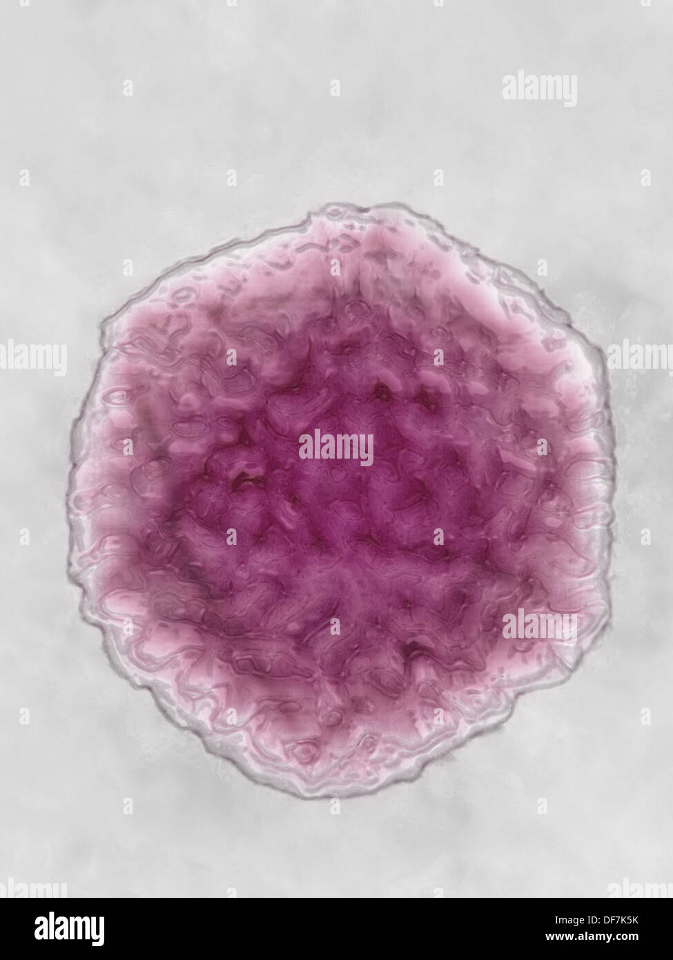 HEPATITIS A VIRUS Stock Photo