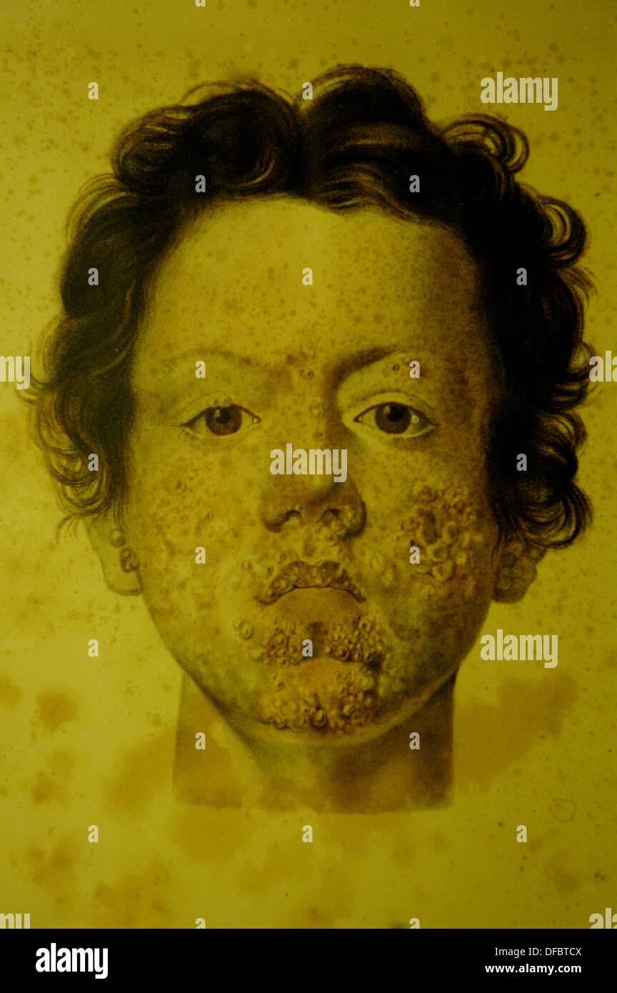 Bologna (Italy), Anatomic Wax Museum at the university, drawning of