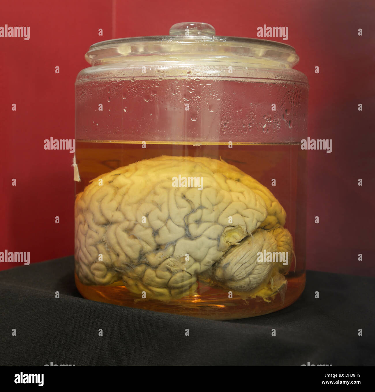 Human brain in a jar, Cornell University.  The brain is part of the Wilder Brain Collection Stock Photo