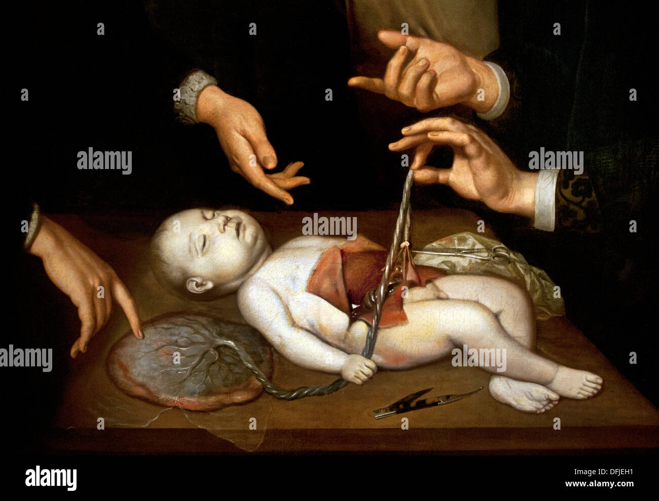 The Anatomy lesson of dr Frederik Ruysch 1683 Jan van Neck Painting Dutch Netherlands Stock Photo