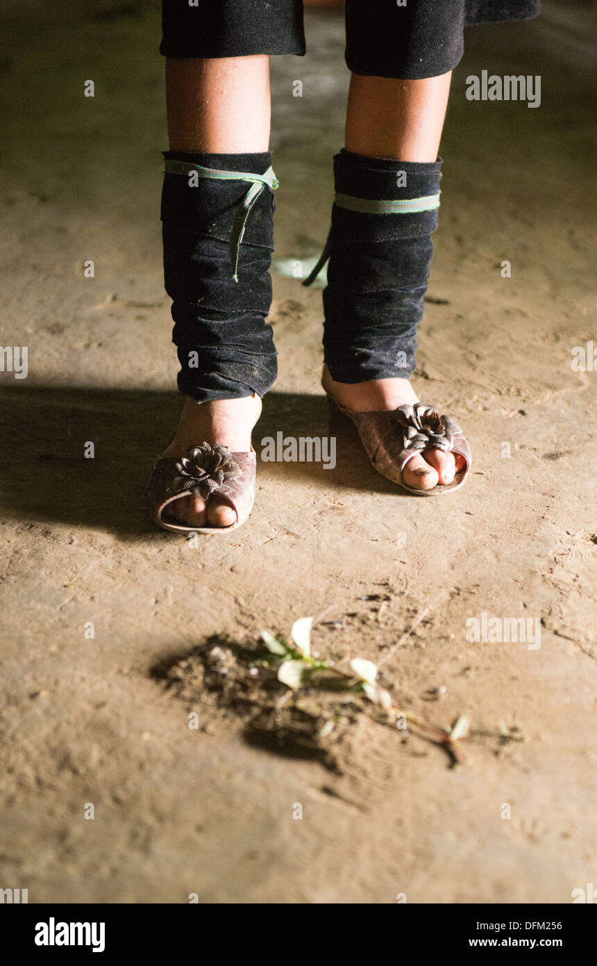 Minority group Black Hmong girl's leg wristlets, Sa Pa, Vitnam Stock ...