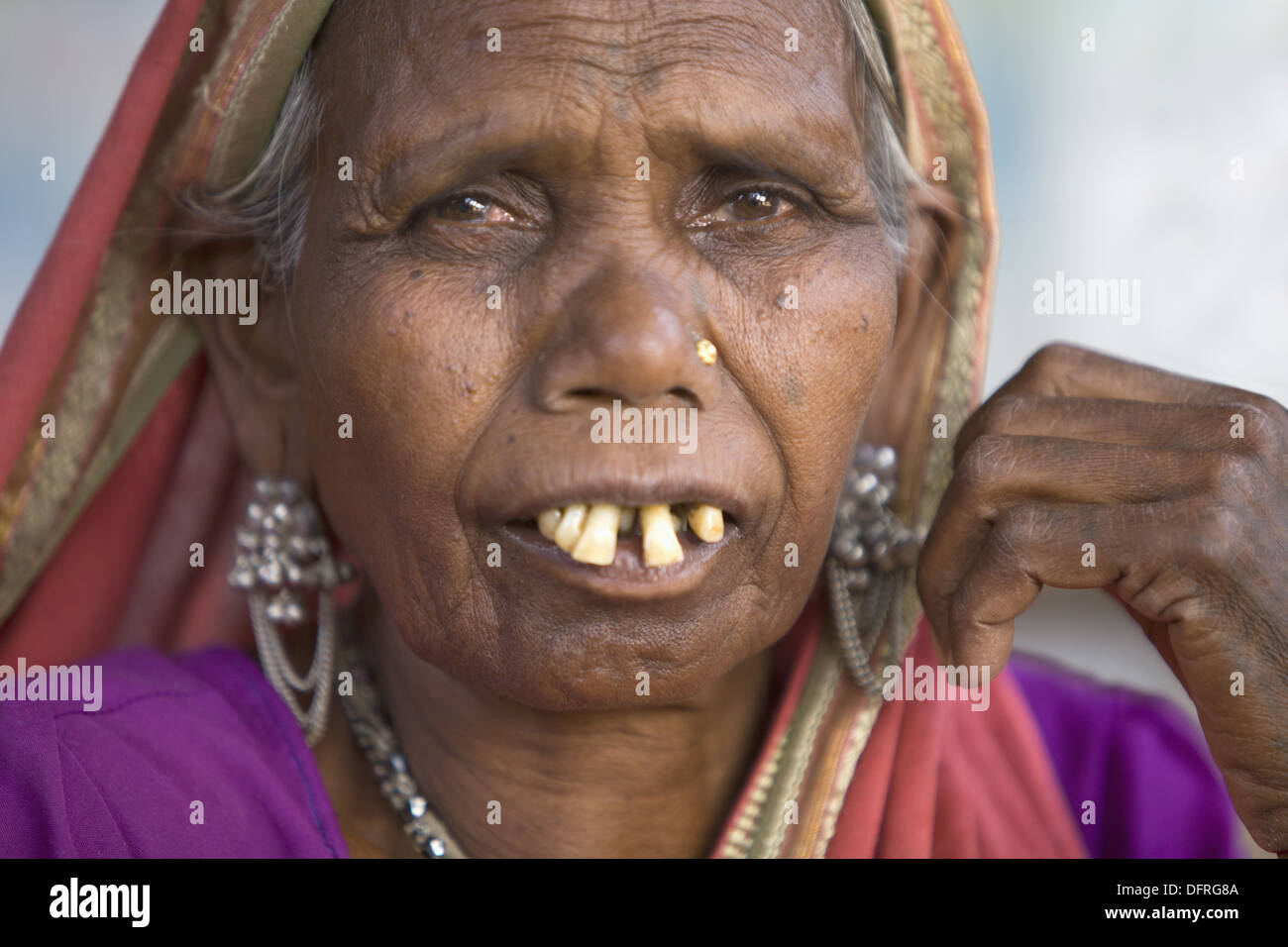 Bucked teeth hi-res stock photography and images - Alamy
