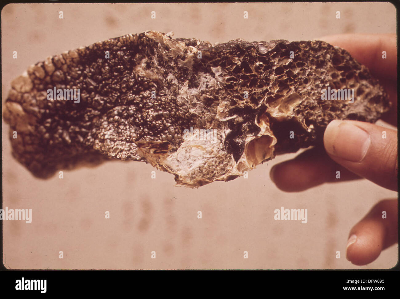 Shrivelled And Hardened Lung Of Black Lung Victim This Disease Often Attacks Miners And Other Ore And Steel Workers 545487 Stock Photo Alamy
