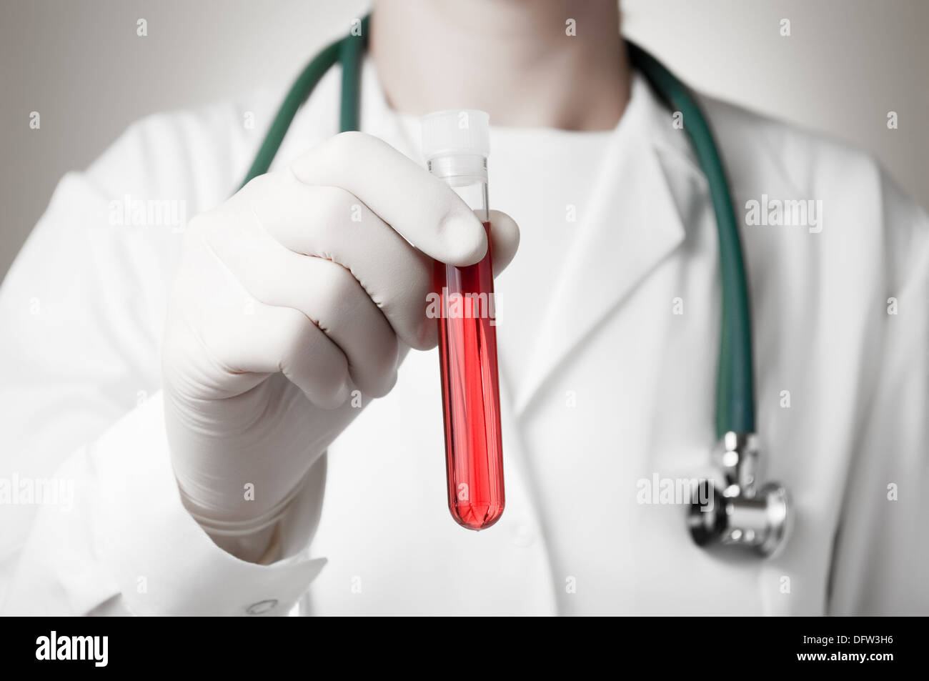 Doctor holding a bottle of blood sample Stock Photo