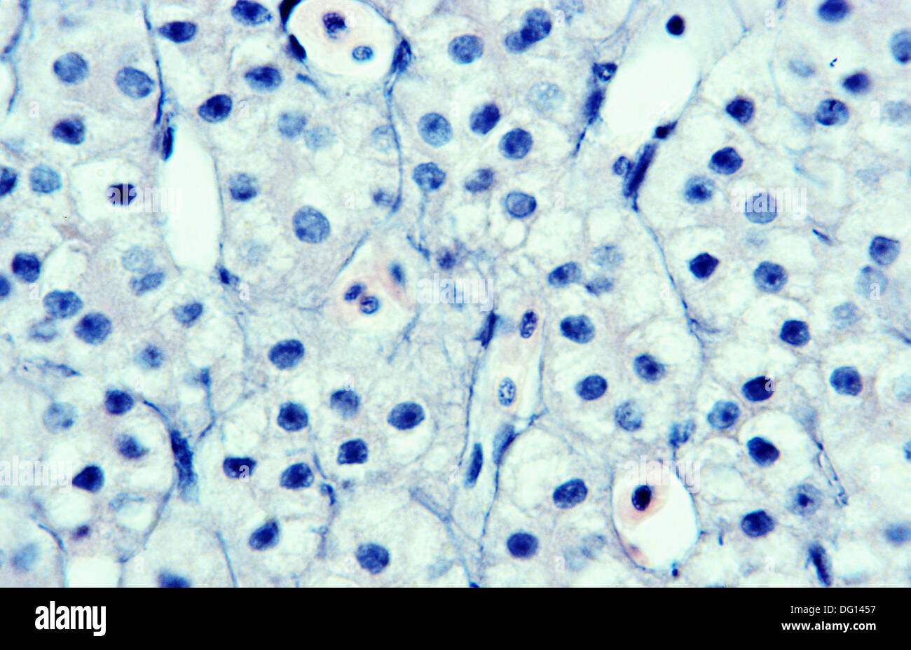 Eel Liver Macrophages Mast Cells Sinusoids 1000 X Optical Microscope Photomicrography Histology Glycogen Digestion Stock Photo Alamy