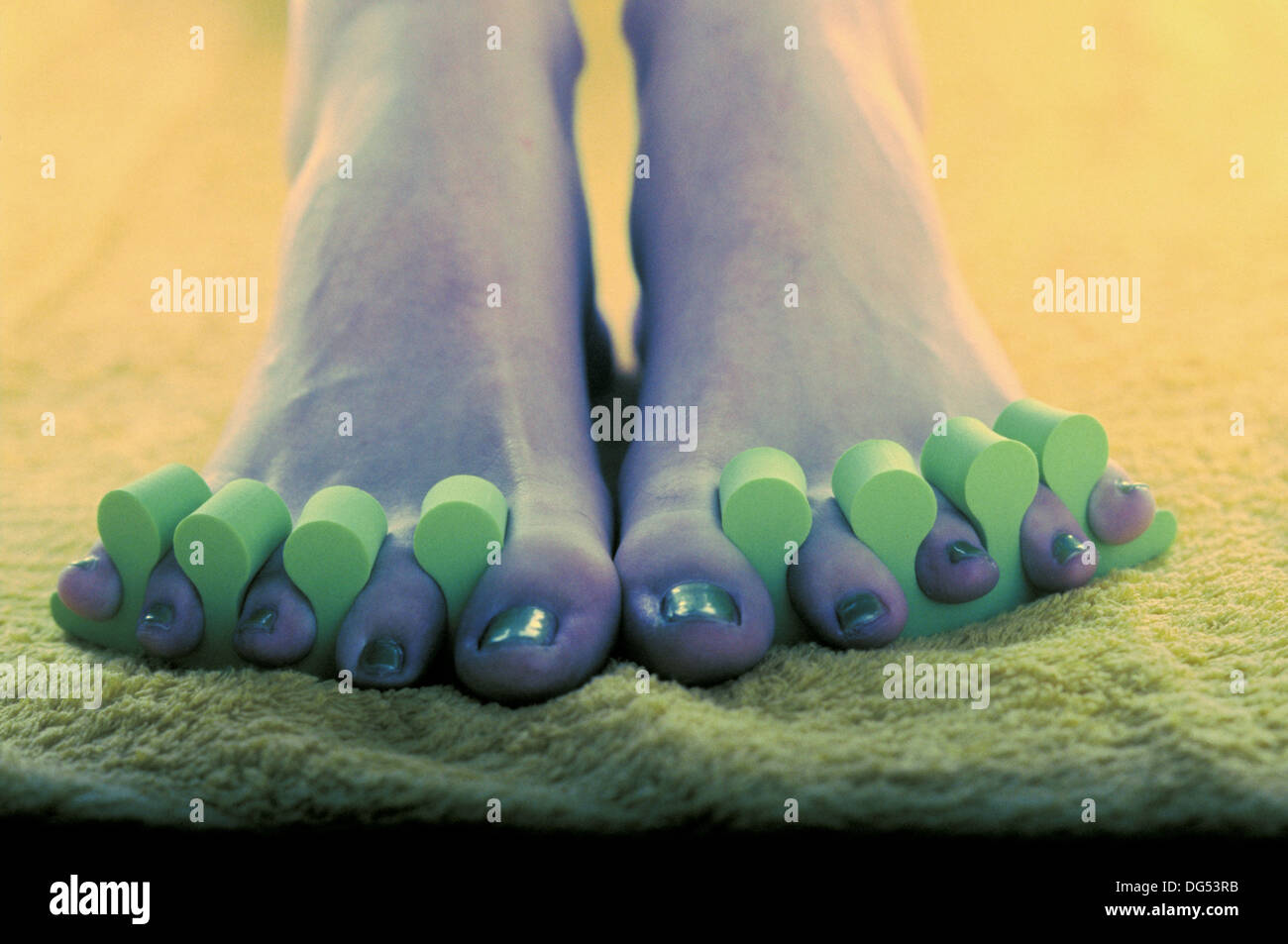 Toenail separation hires stock photography and images Alamy