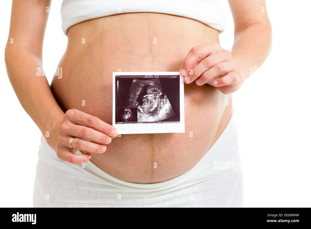 pregnant woman holding ultrasound scan on her belly Stock Photo