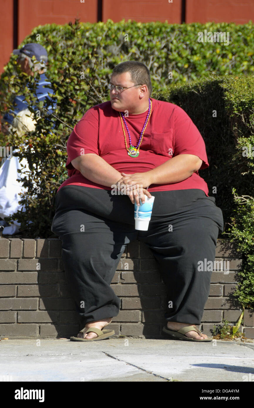 Morbidly obese hi-res stock photography and images - Alamy