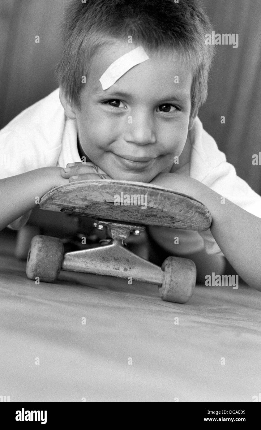 Child head injury Black and White Stock Photos & Images - Alamy