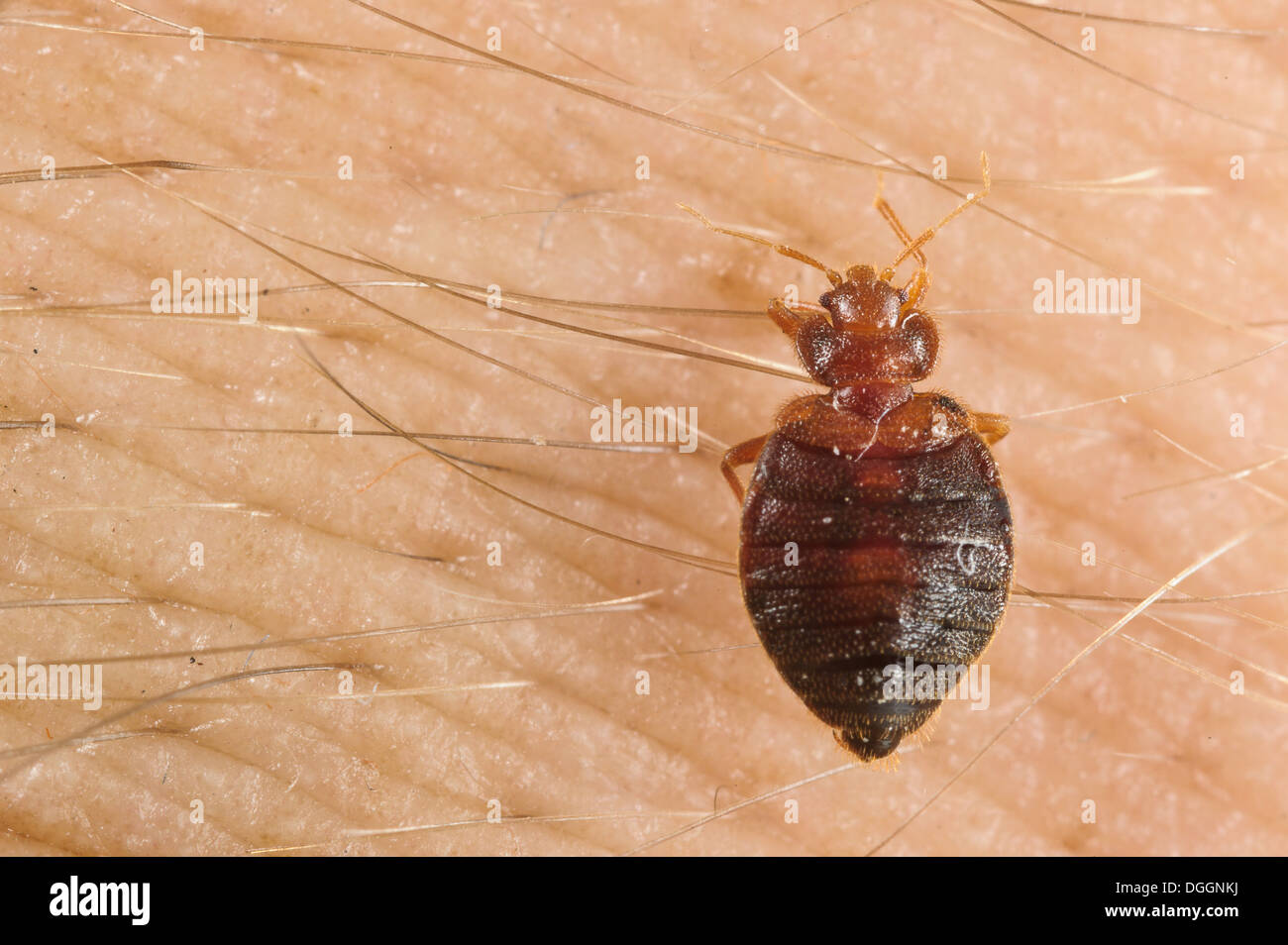 Common Bedbug (Cimex lectularius) adult, sucking blood from human skin, Italy, July Stock Photo