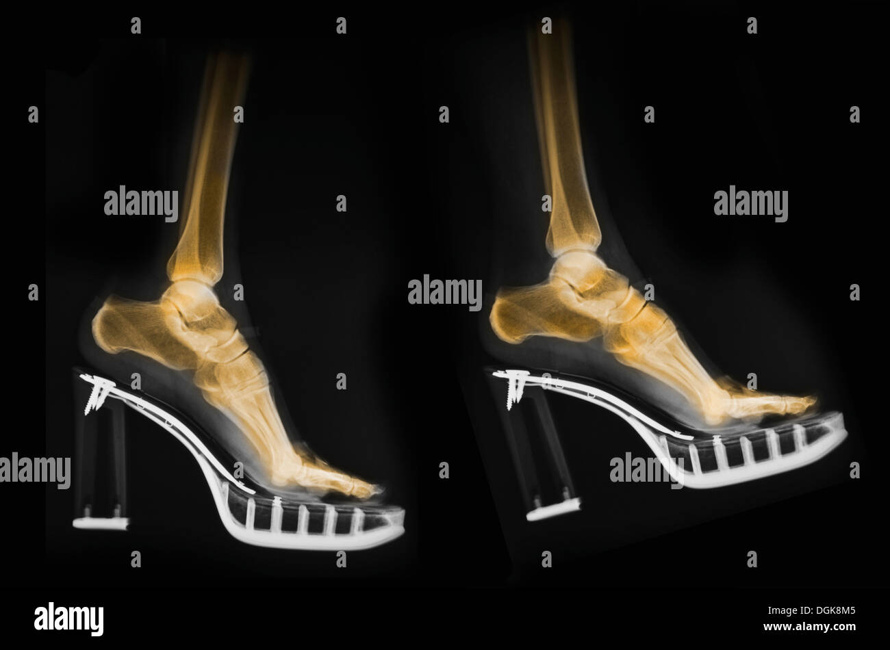 Xray of feet in a pair of high heel shoes Stock Photo Alamy