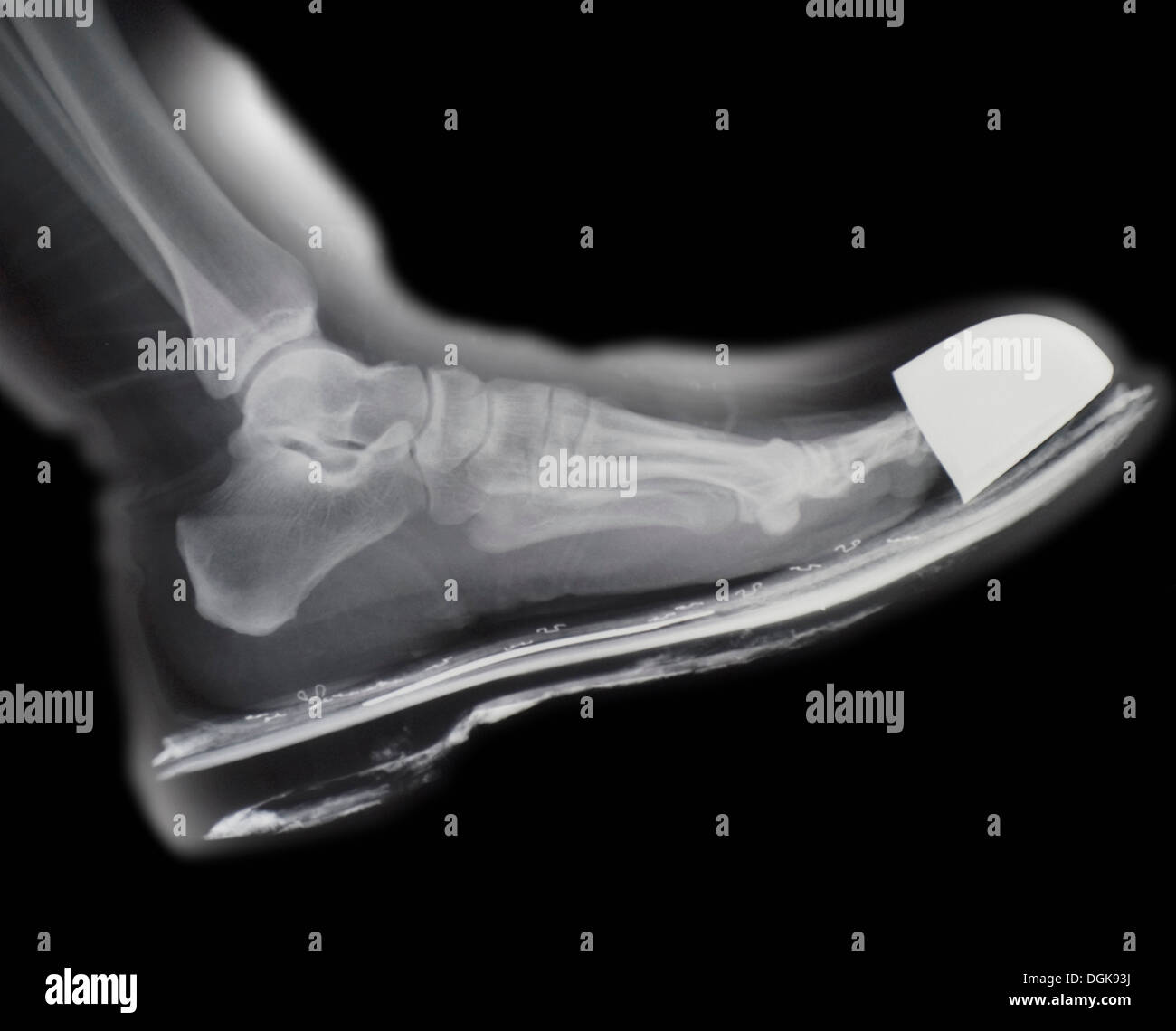 Foot xray and shoe hi-res stock photography and images - Alamy
