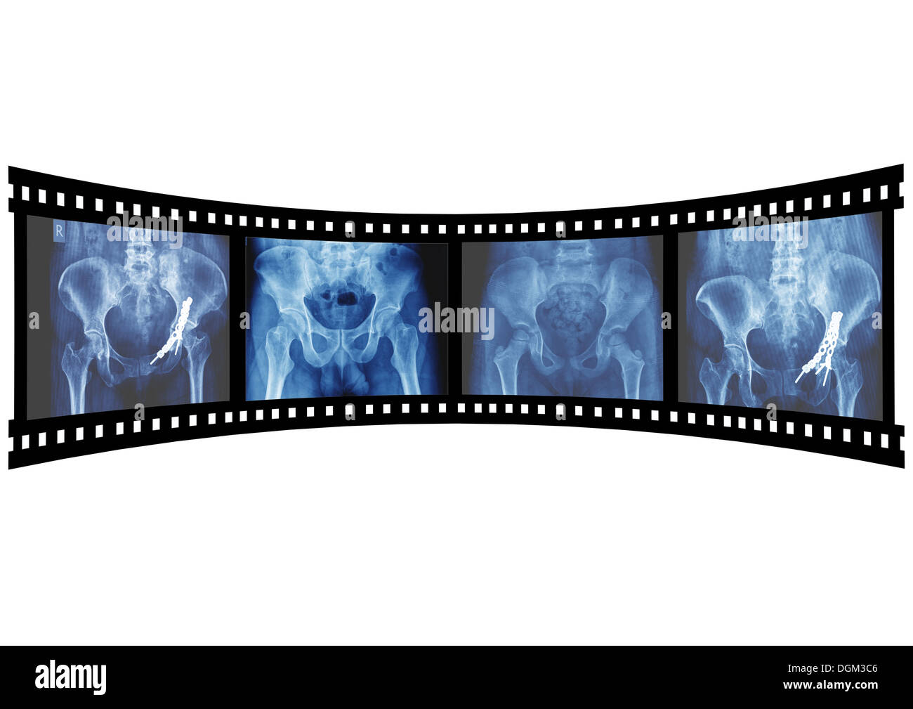 Xradiation of Xrays) is a form of radiation