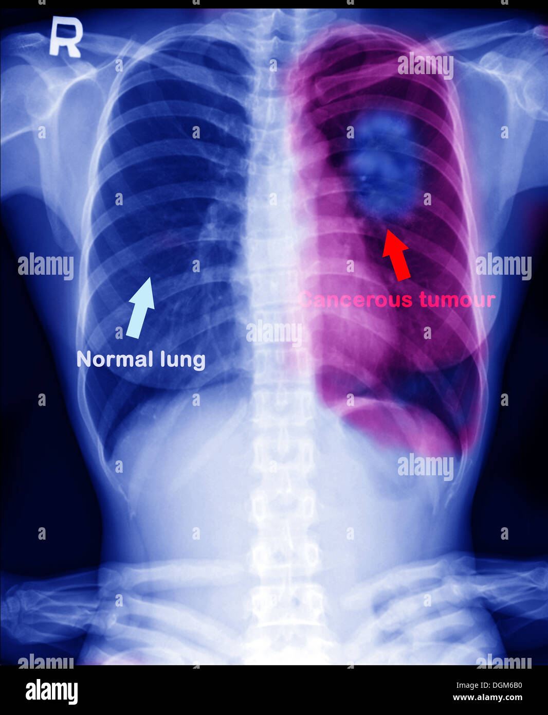 Xradiation of Xrays) is a form of radiation