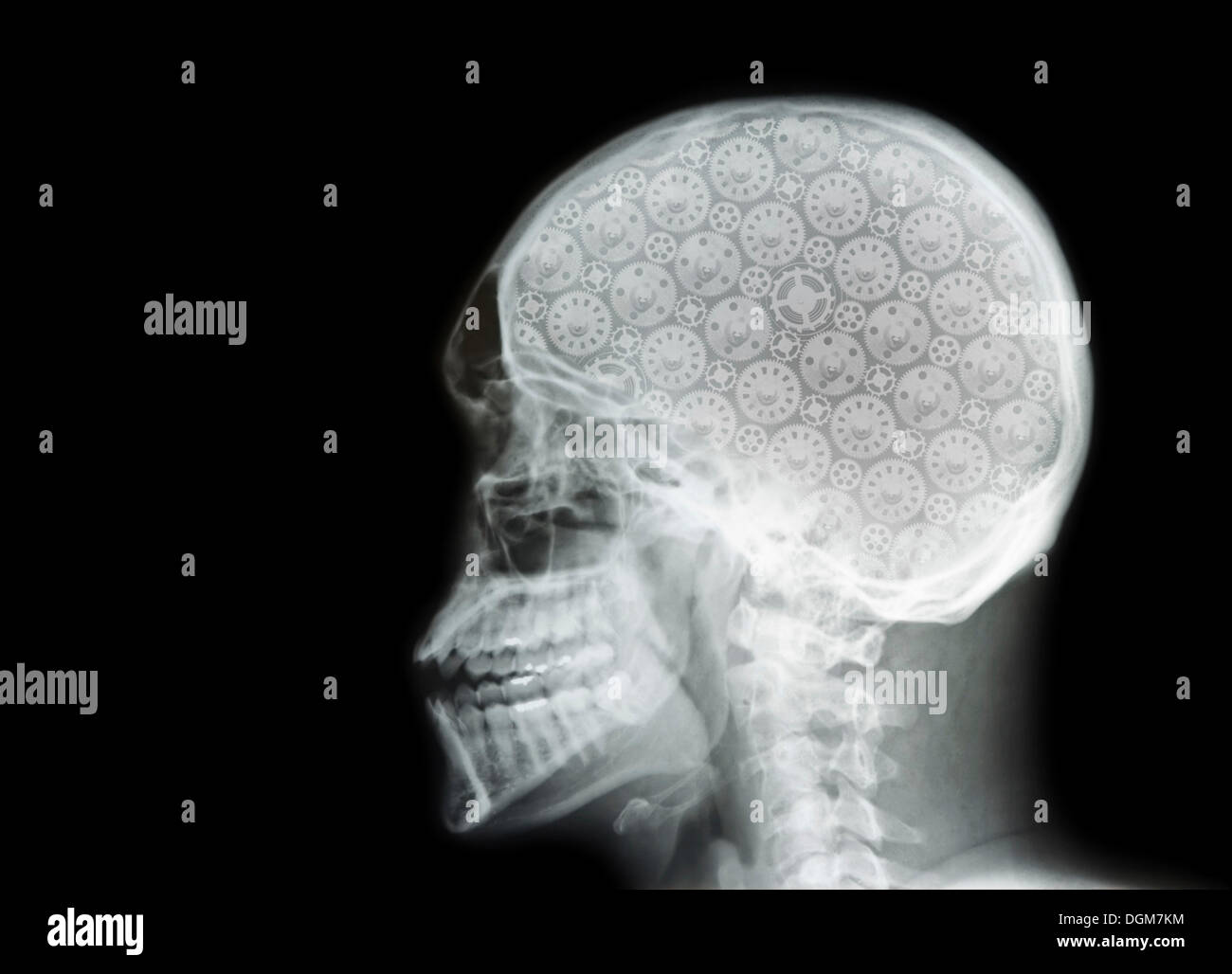 X-ray of a skull with cogs Stock Photo