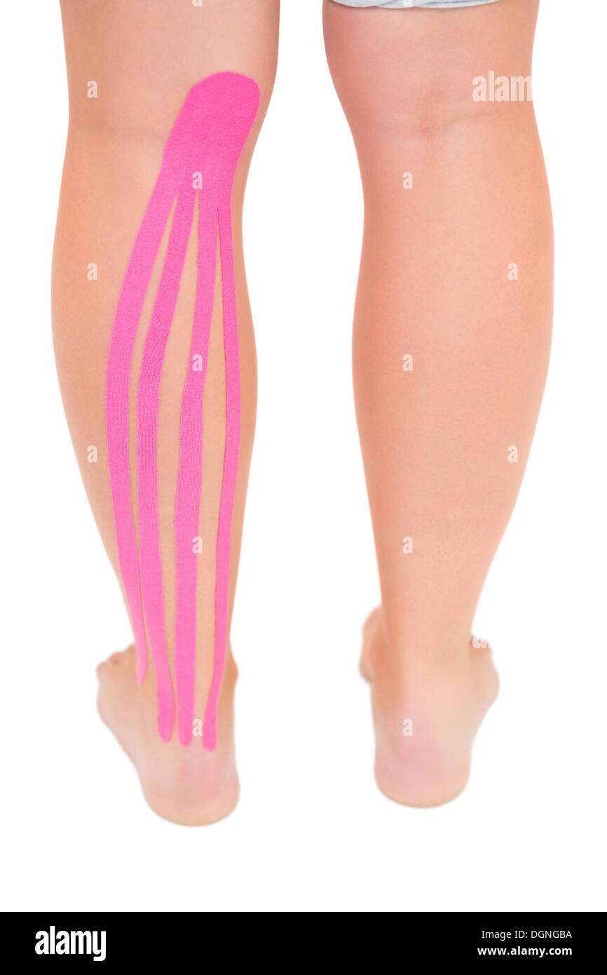 Patients leg with applied kinesio tape Stock Photo Alamy