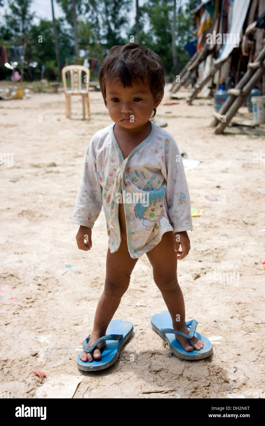 A young girl is wearing a pair of adult rubber sandals in a slum near a  large garbage dump in Phnom Penh, Cambodia Stock Photo - Alamy