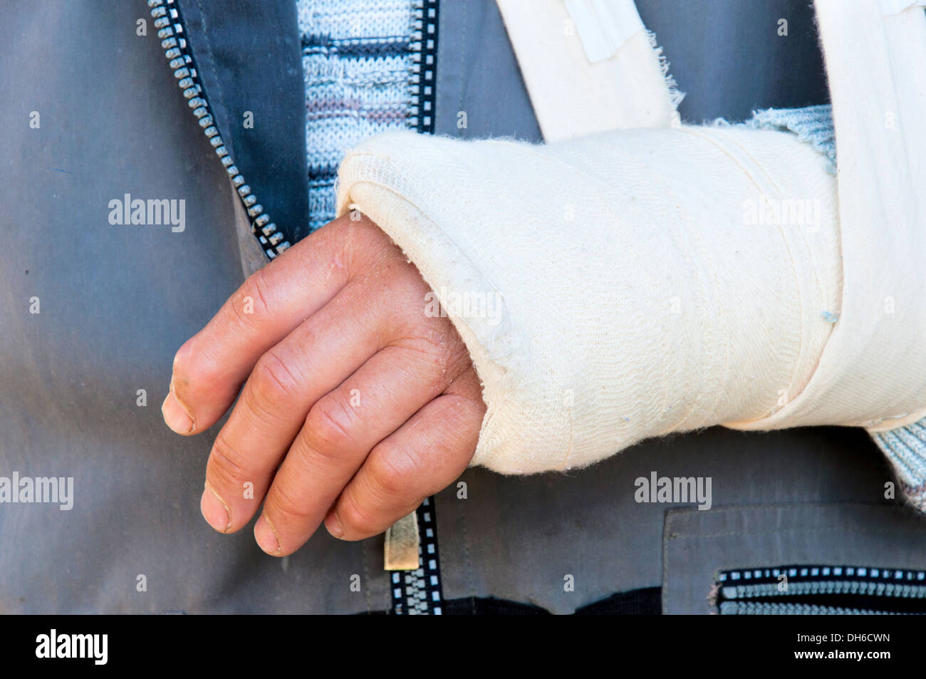 Man's arm in cast and sling Stock Photo Alamy