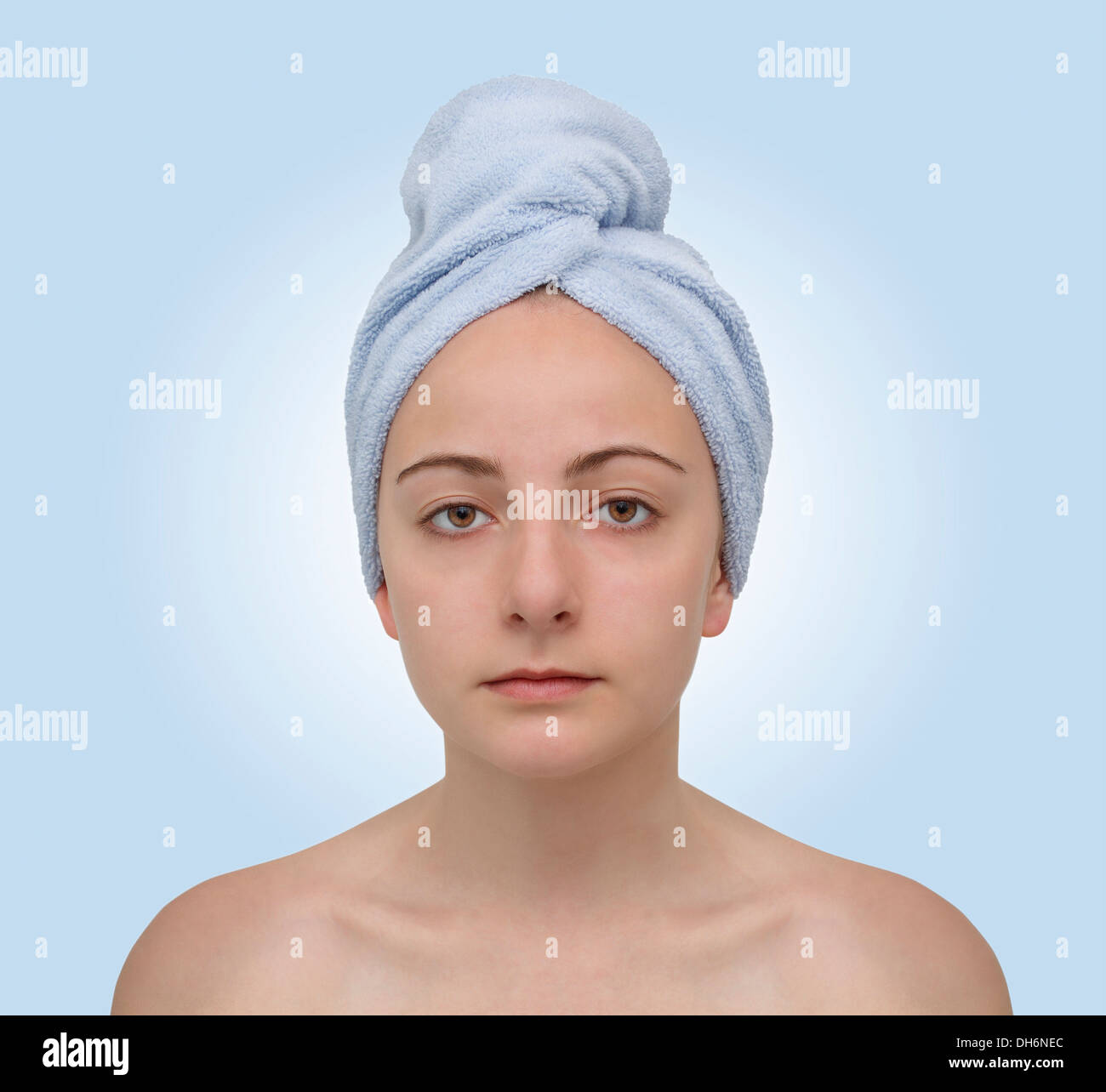 Puberty skin hi-res stock photography and images - Alamy
