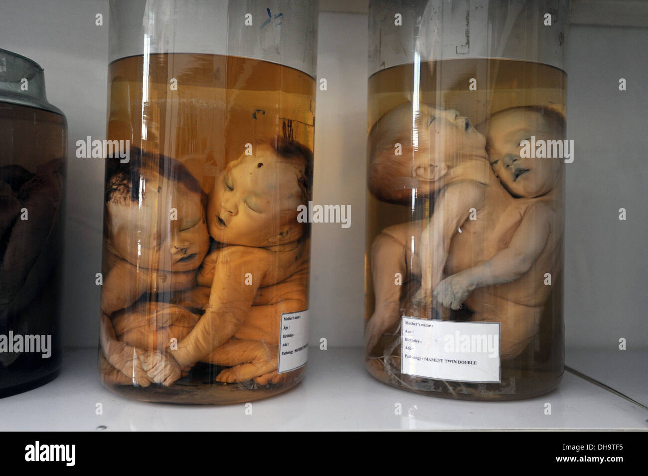 A “reference room” filled with jars of deformed, stillborn fetuses is