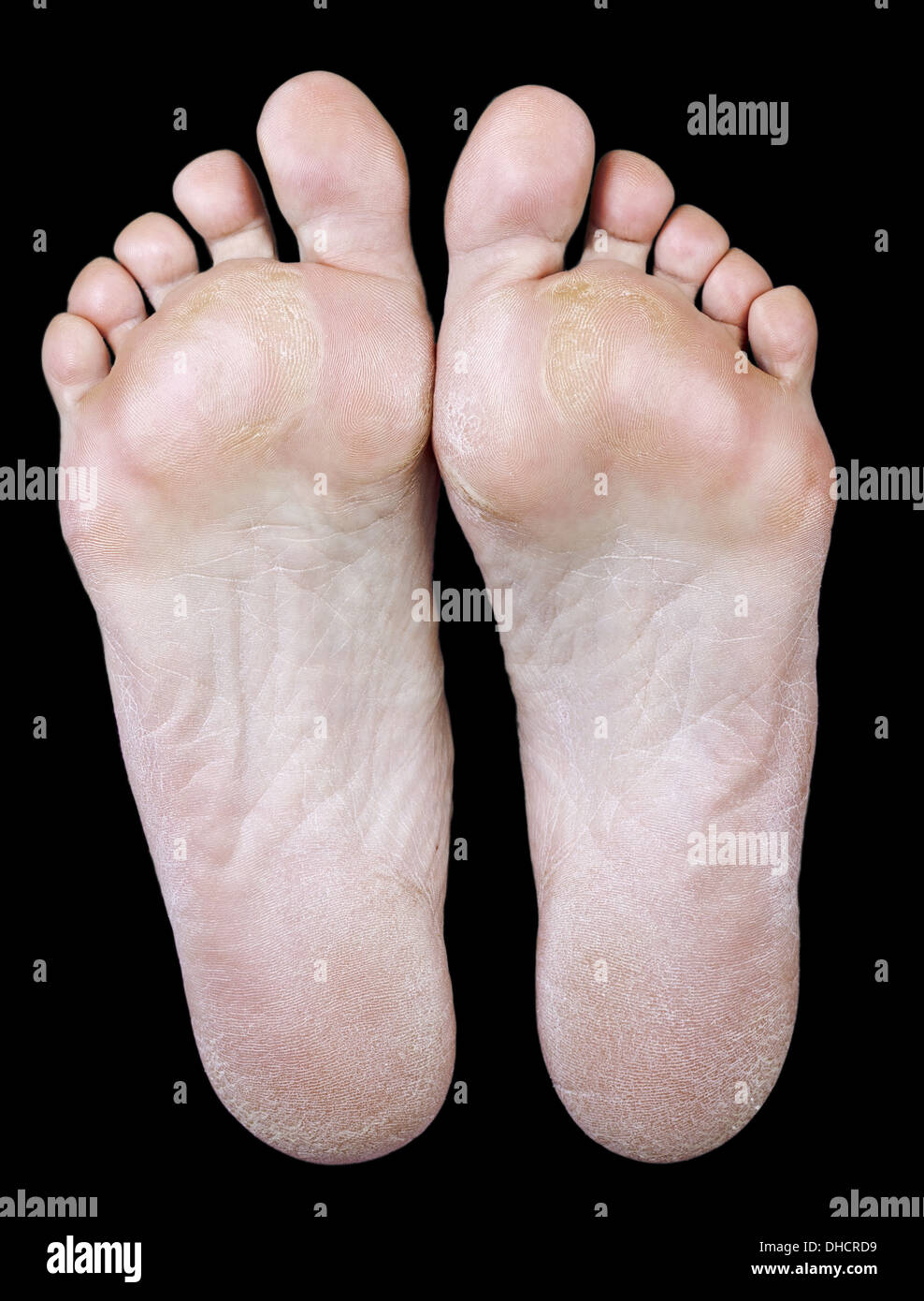 Yellow callus hires stock photography and images Alamy