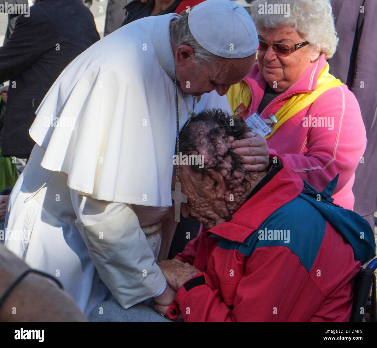 Vatican, Rome, Italy. 06th Nov, 2013. Vatican Pope Francis, general audience 06 November 2013 Pope Francis hug and bless a person sick of neurofibromatosis during the general audience of 6 November in St Peter square © Realy Easy Star/Alamy Live News Stock Photo