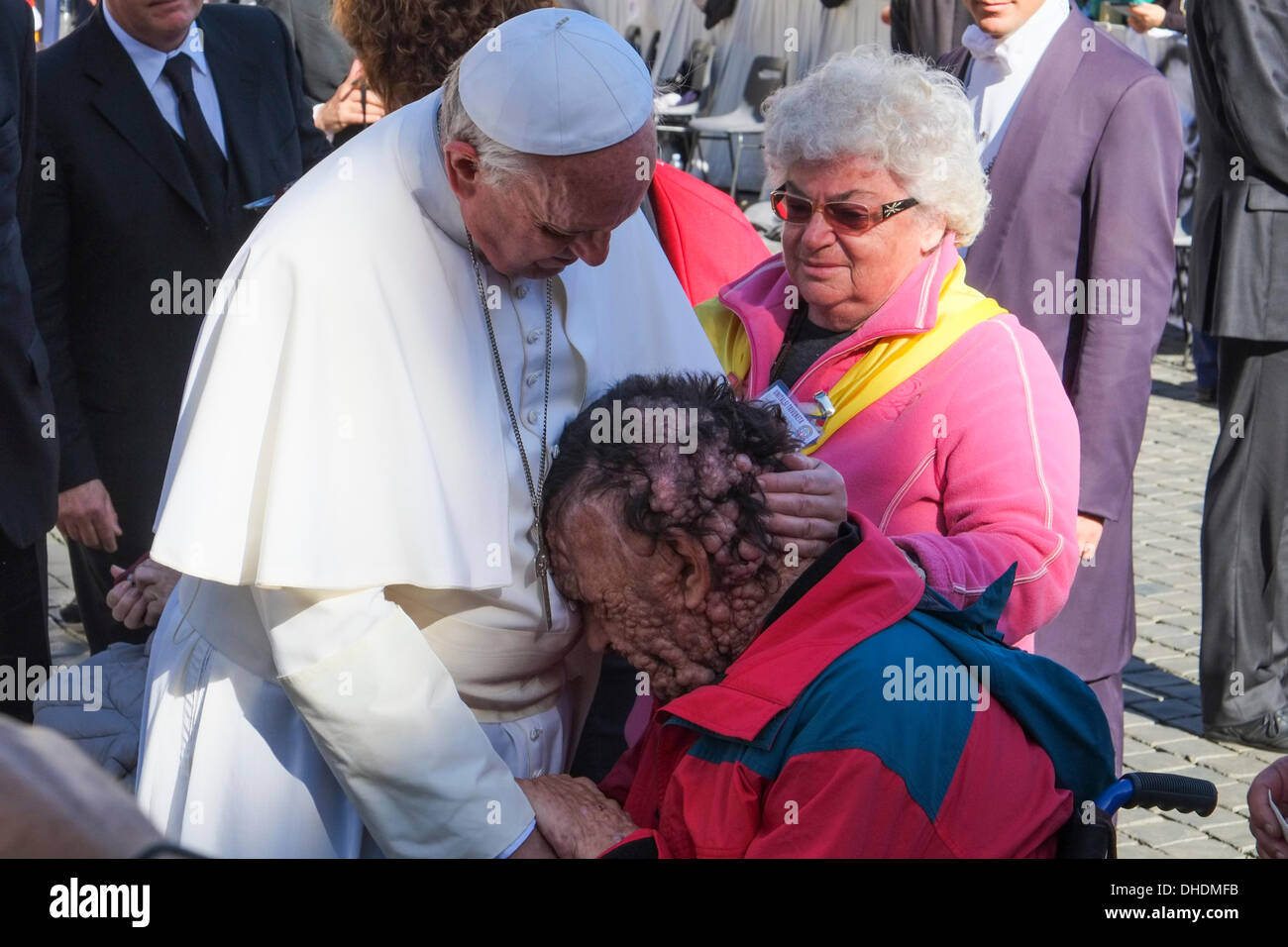 Vatican, Rome, Italy. 06th Nov, 2013. Vatican Pope Francis, general audience 06 November 2013 Pope Francis hug and bless a person sick of neurofibromatosis during the general audience of 6 November in St Peter square © Realy Easy Star/Alamy Live News Stock Photo