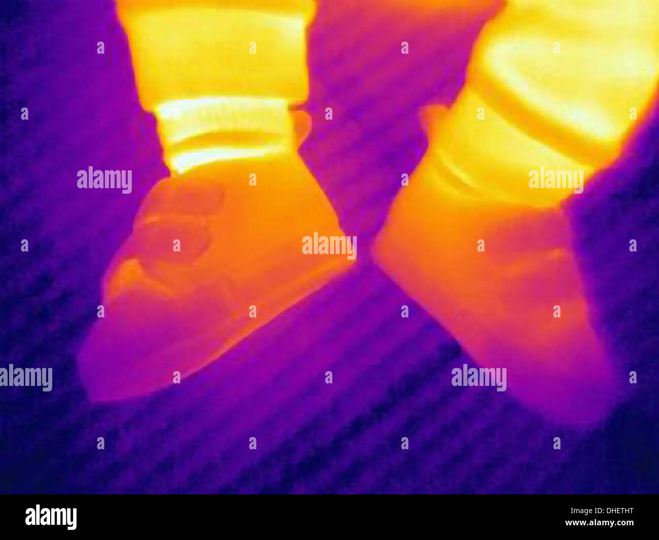 Thermal image of shoes of three month old baby Stock Photo Alamy