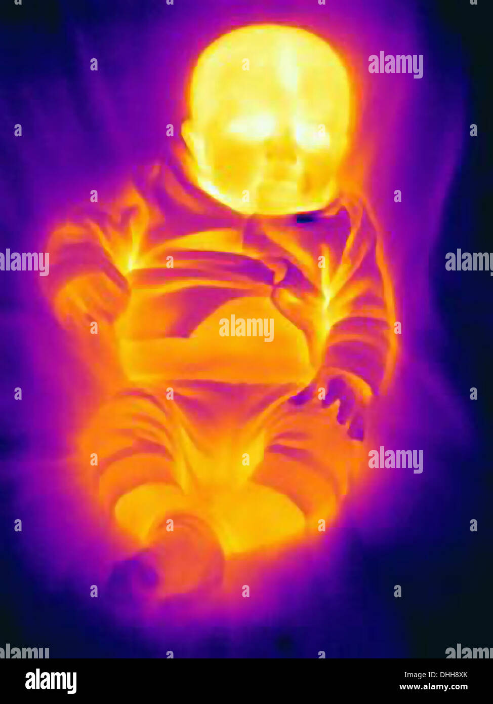 Thermal image of three month old baby Stock Photo