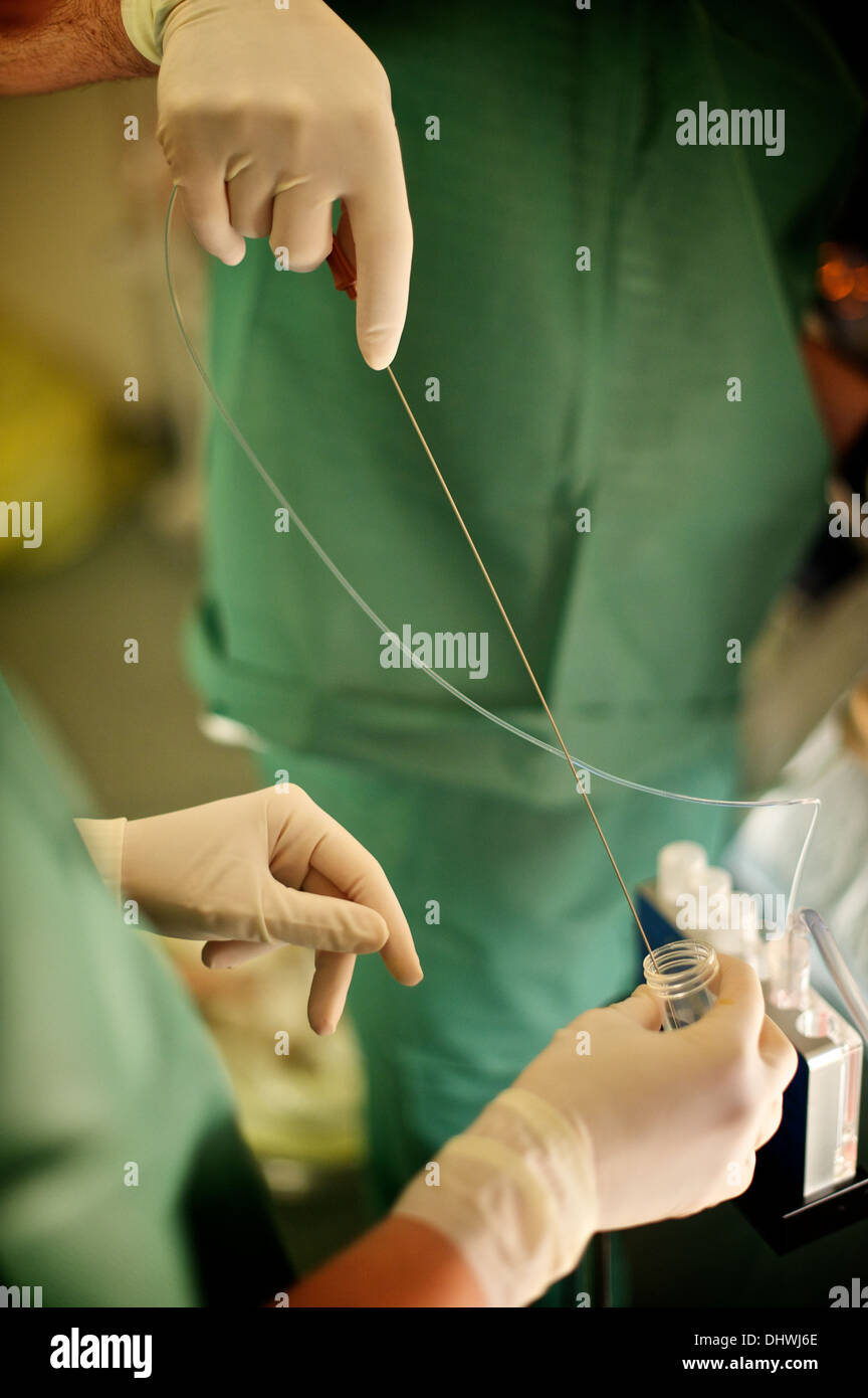 Ivf needle hires stock photography and images Alamy