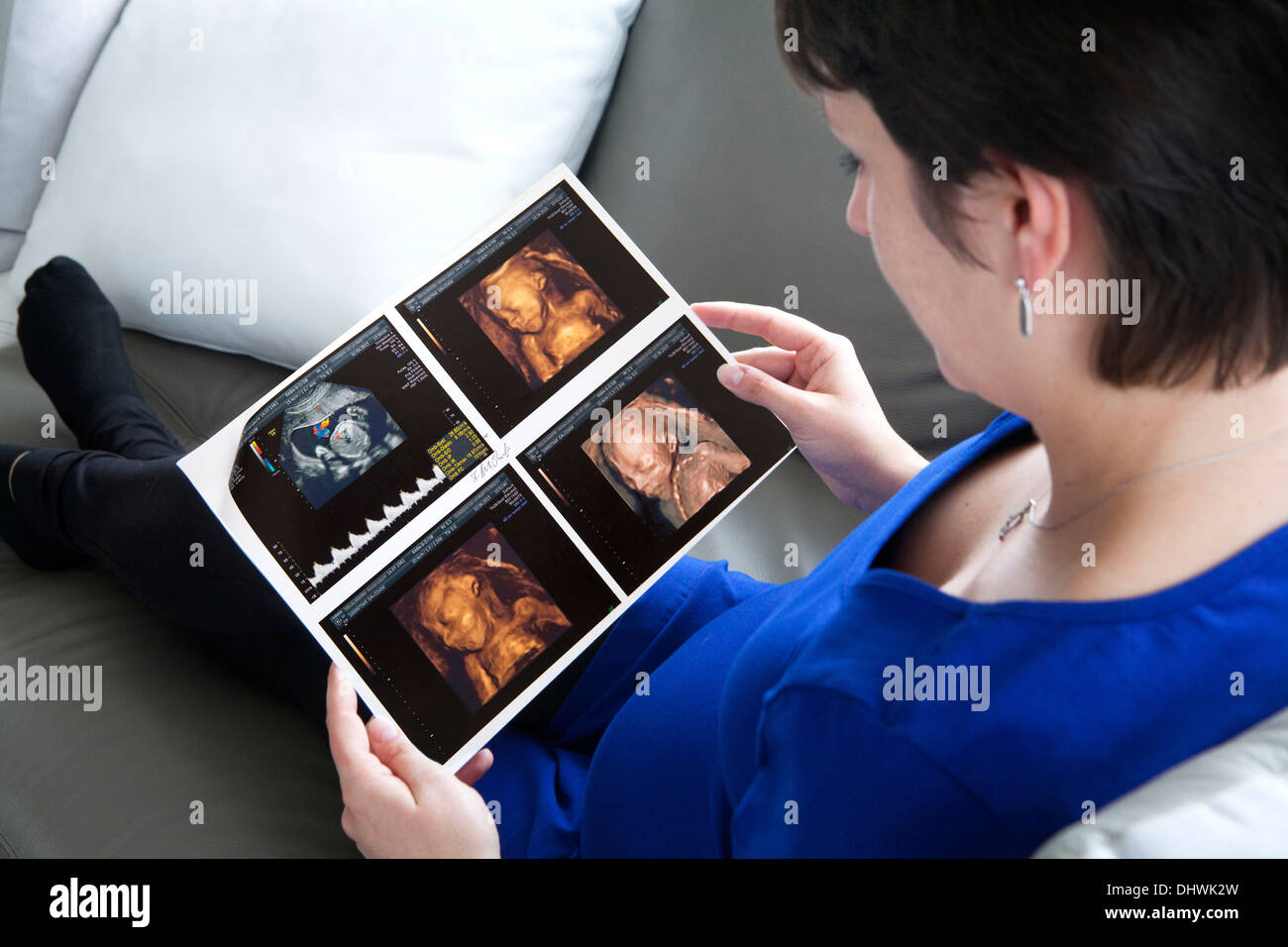 Ultrasonography hi-res stock photography and images - Alamy