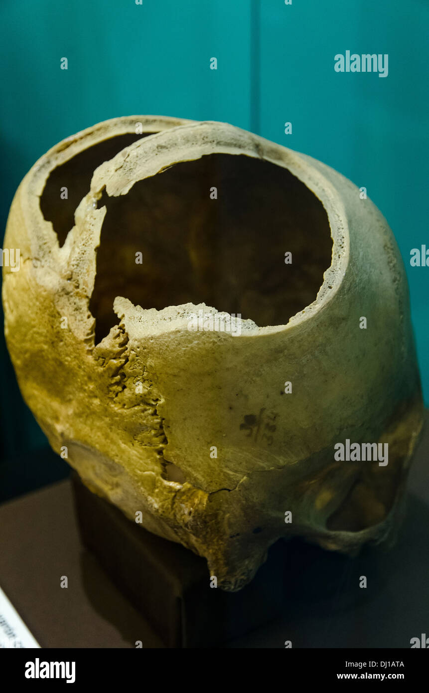 Deformed skulls of Paracas. Stock Photo