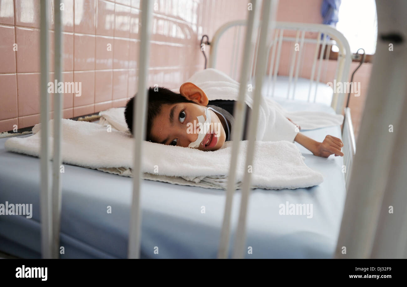 A physically and mentally disabled child lies in a hospital bed at