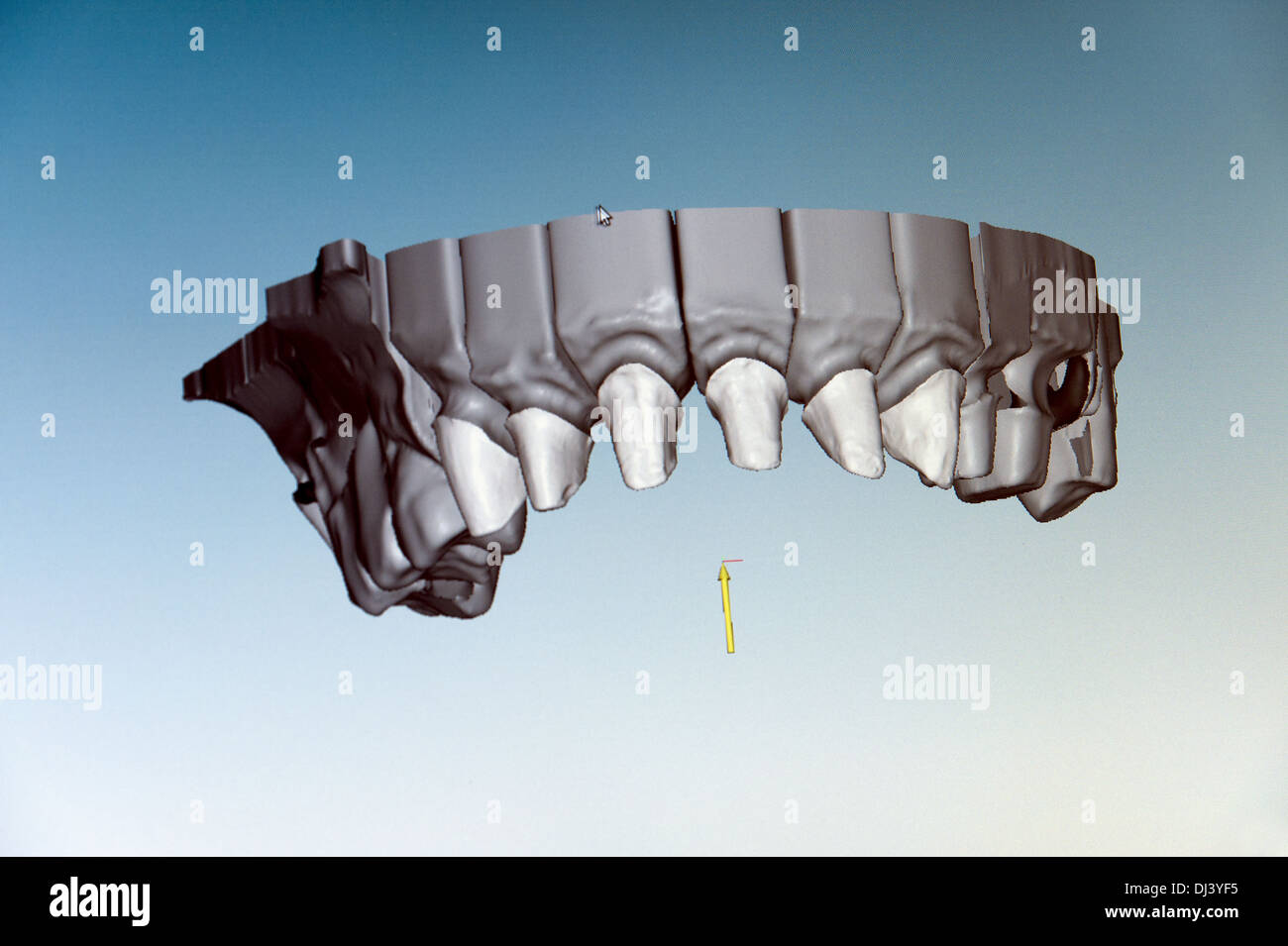 Computer model of the upper jaw Stock Photo