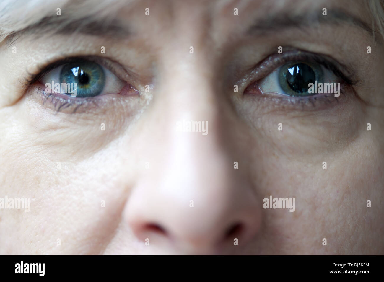 Anisocoria, or differently sized pupils 72 Anisocoria, or differently sized pupils 85