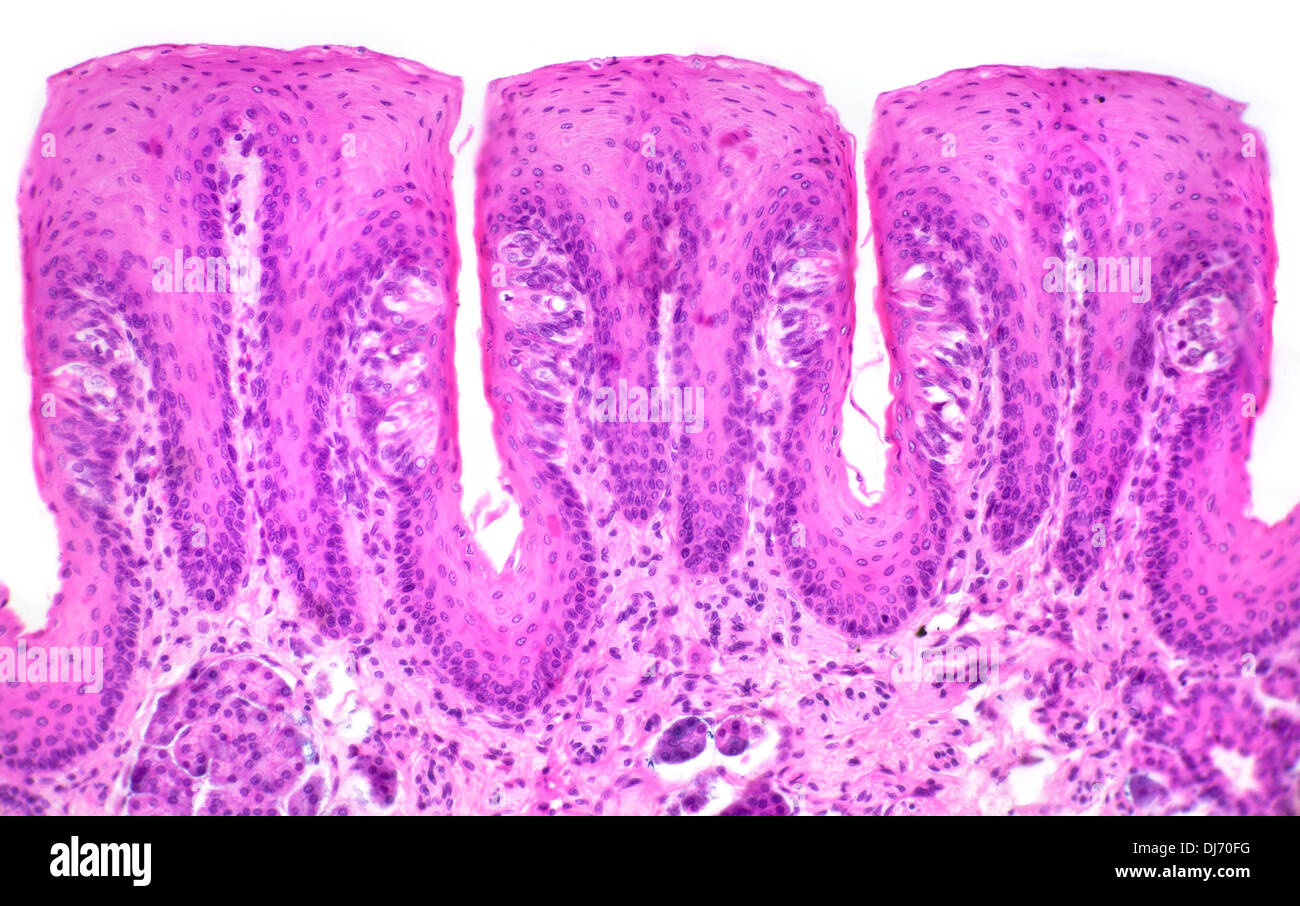 Papillae taste buds, human tongue, bright field photomicrograph, micrograph. Stock Photo