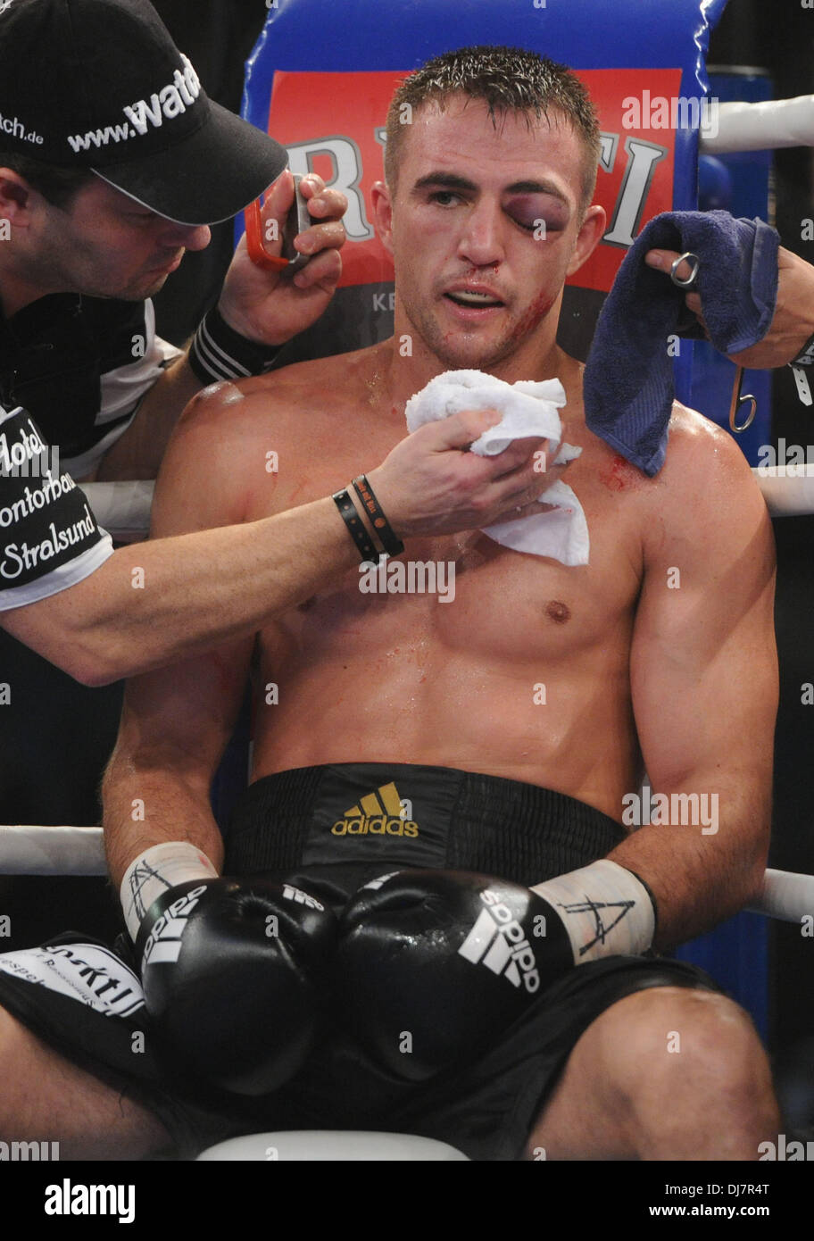 How Do Boxers Reduce Eye Swelling