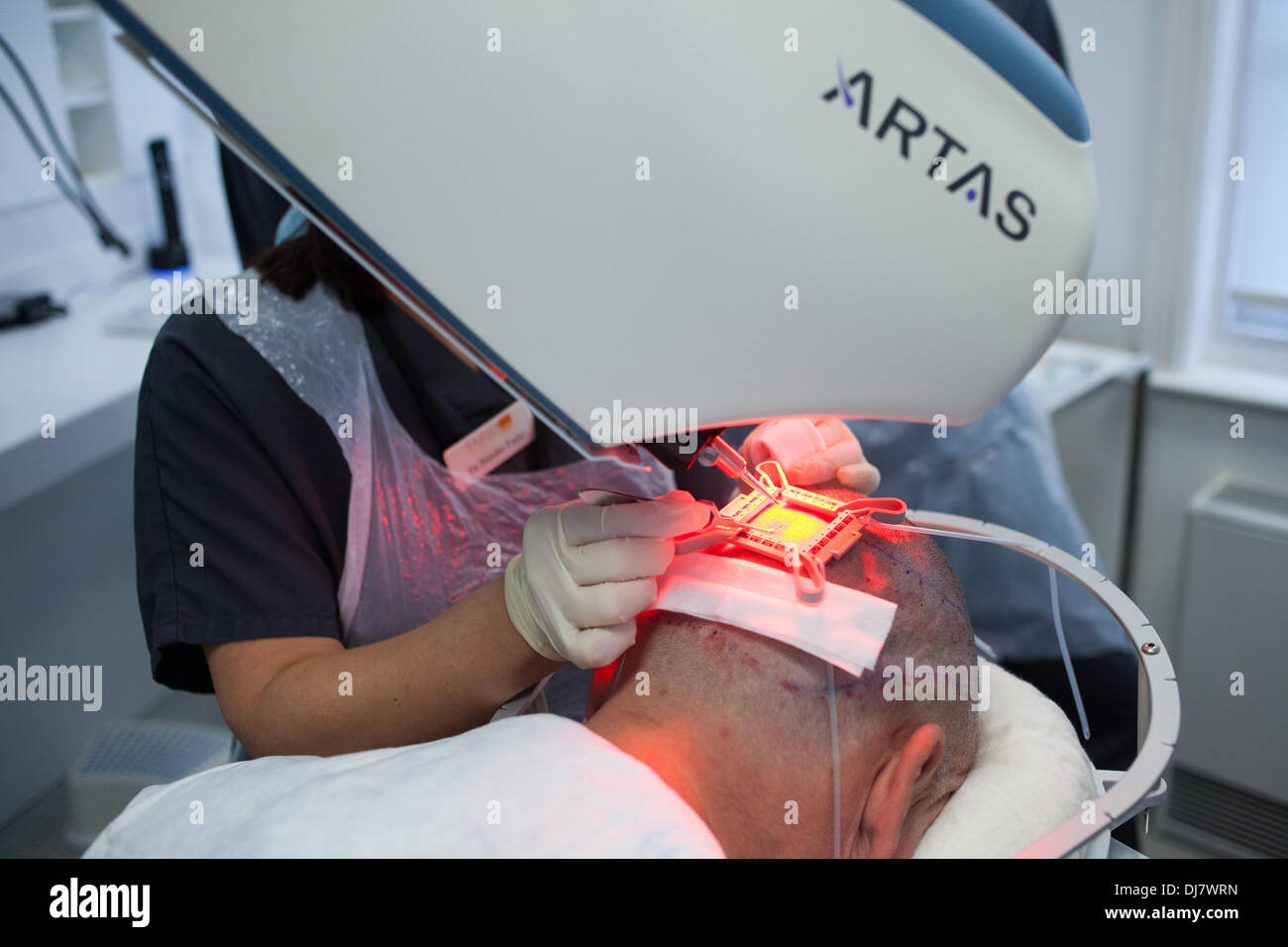 ARTAS robotic hair transplant machine being used at Farjo Hair Institute on Quay Street in Manchester Stock Photo