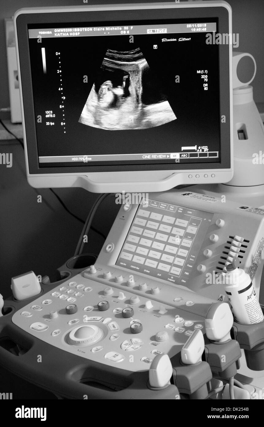 Ultrasound Black and White Stock Photos & Images Alamy