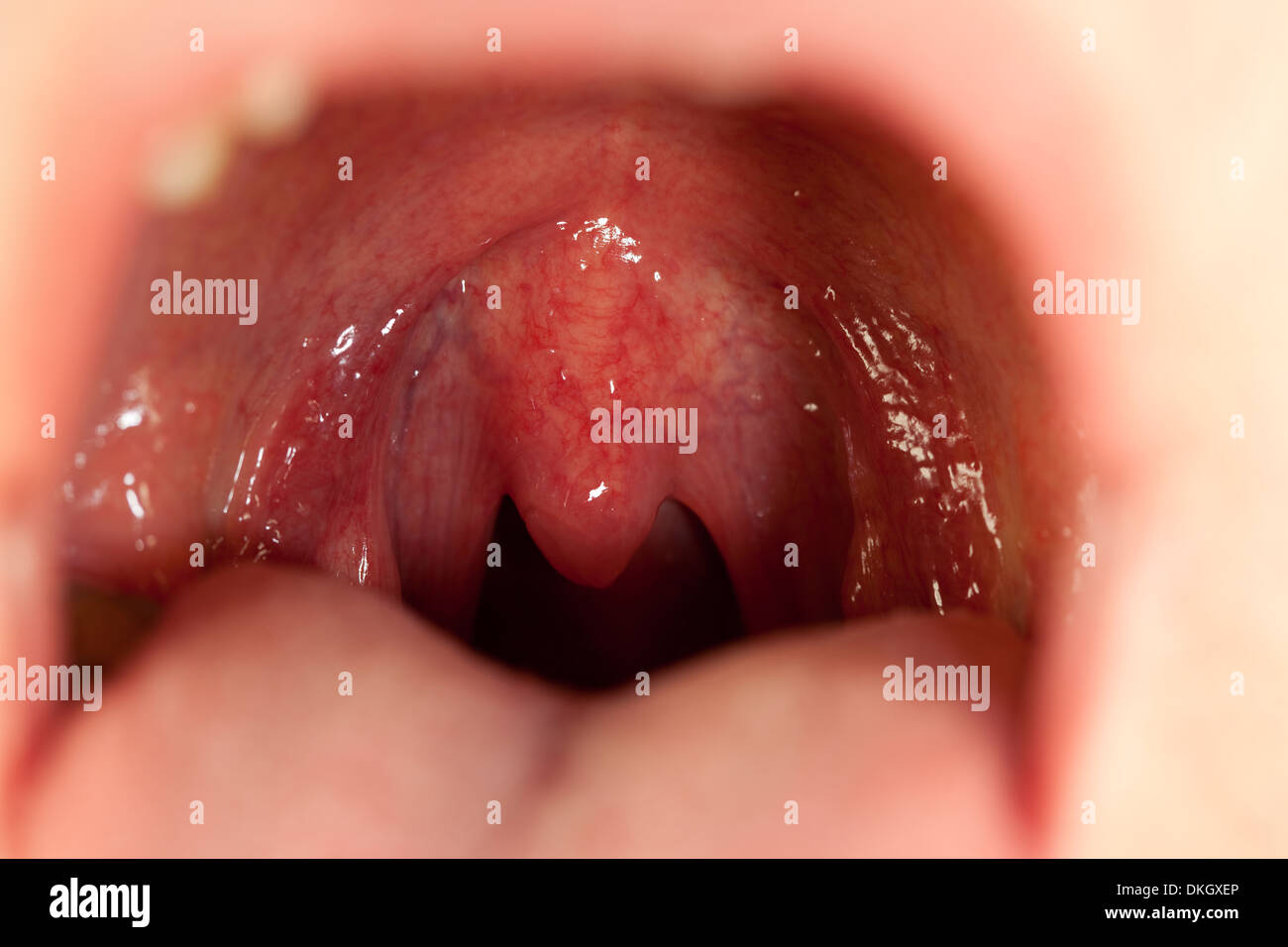 human throat in centre with tongue Stock Photo