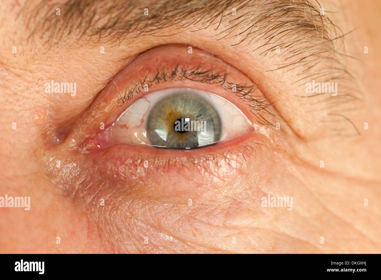 opening human eye with red eyeball Stock Photo