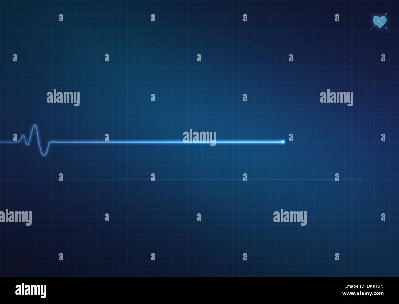 Flatline blip on a medical heart monitor EKG (electrocardiogram) with