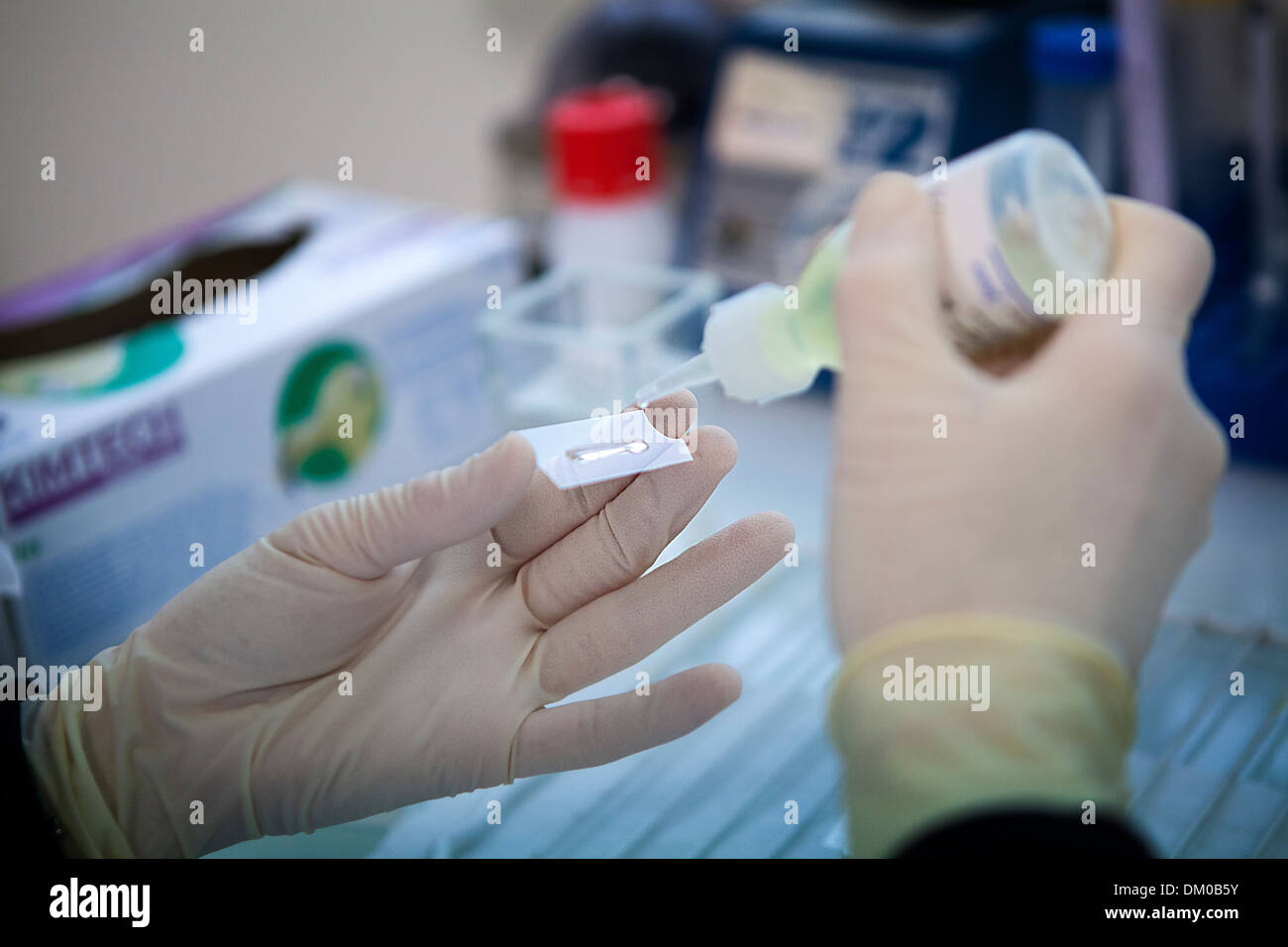 Slide on cancer hi-res stock photography and images - Alamy