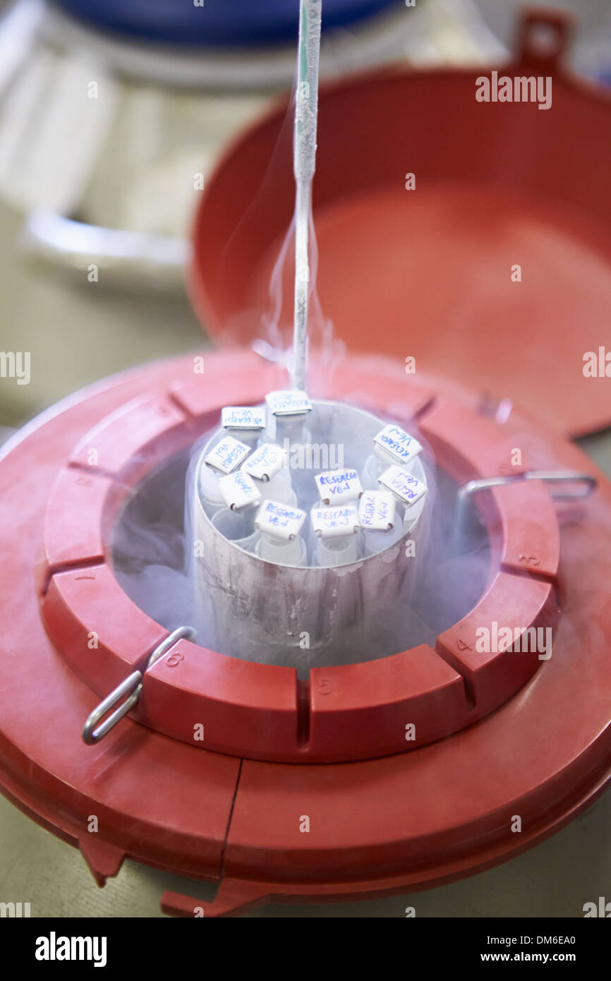 Frozen Storage At Sperm Bank Stock Photo - Alamy 80's THE SPERM