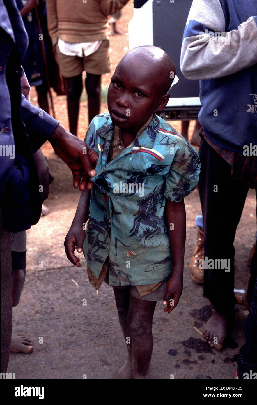 Machete wound hires stock photography and images Alamy