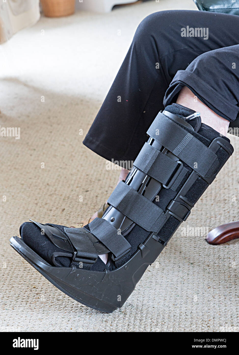 Modern reusable cast for broken ankle as used in UK hospitals Stock Photo