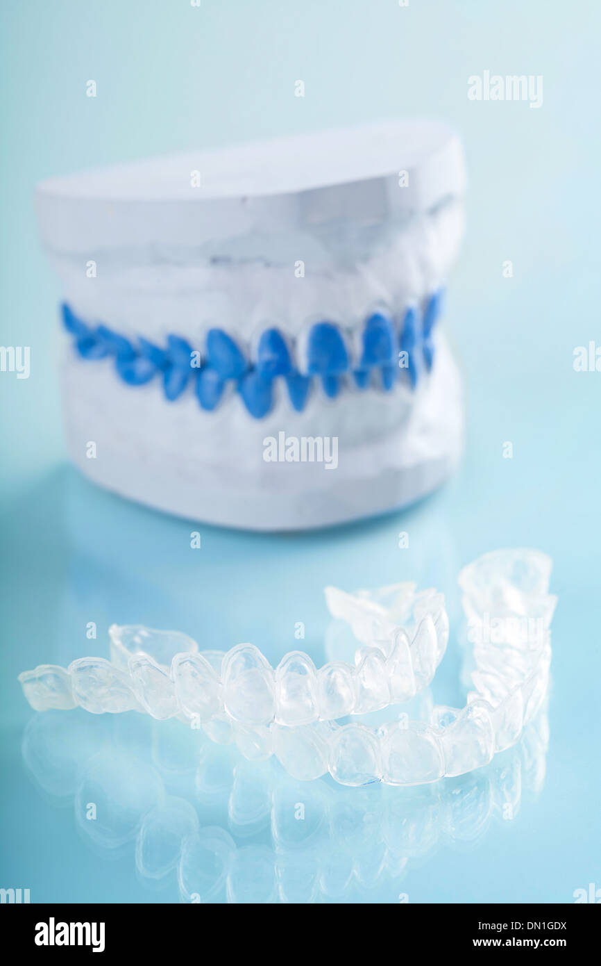 individual tooth tray for whitening Stock Photo Alamy